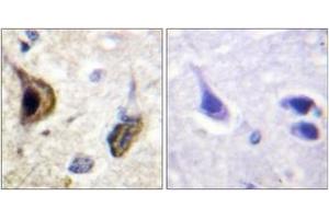 Immunohistochemistry analysis of paraffin-embedded human brain, using Kir5.