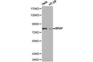 Western Blotting (WB) image for anti-B-Raf proto-oncogene, serine/threonine kinase (BRAF) antibody (ABIN1871340) (BRAF anticorps)