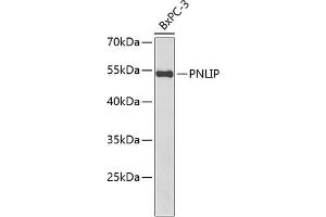 Western blot analysis of extracts of BxPC-3 cells, using PNLIP antibody  at 1:1000 dilution. (PNLIP anticorps  (AA 166-465))