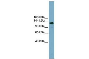 WB Suggested Anti-ASXL2 Antibody Titration: 0.