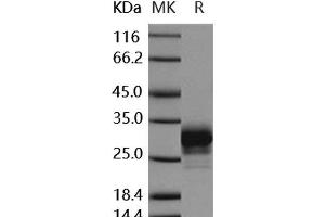 Western Blotting (WB) image for Fc Fragment of IgG, Low Affinity IIa, Receptor (CD32) (FCGR2A) (Active) protein (His tag) (ABIN7195679)