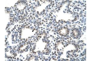 SLC10A5 antibody was used for immunohistochemistry at a concentration of 4-8 ug/ml to stain Alveolar cells (arrows) in Human Lung. (SLC10A5 anticorps)