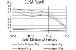 Black line: Control Antigen (100 ng),Purple line: Antigen (10 ng), Blue line: Antigen (50 ng), Red line:Antigen (100 ng)