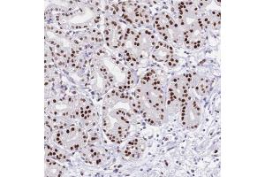 Immunohistochemical staining of human stomach with NFIC polyclonal antibody  shows strong nuclear positivity in glandular cells.
