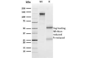 SDS-PAGE Analysis Purified n-Myc Mouse Monoclonal Antibody (NMYC-1). (MYCN anticorps)