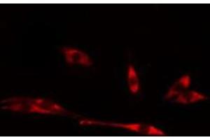 ABIN6275011 staining LOVO cells by IF/ICC. (CHPF anticorps  (C-Term))