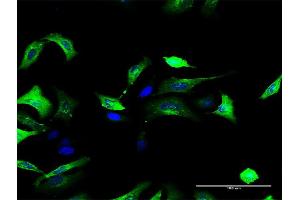 Immunofluorescence of purified MaxPab antibody to FOLR1 on HeLa cell. (FOLR1 anticorps  (AA 1-257))