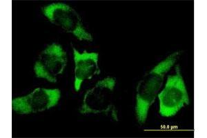Immunofluorescence of purified MaxPab antibody to USP10 on HeLa cell. (USP10 anticorps  (AA 1-798))