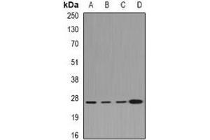 Western blot analysis of CLIC1 expression in Hela (A), HepG2 (B), mouse lung (C), rat kidney (D) whole cell lysates.