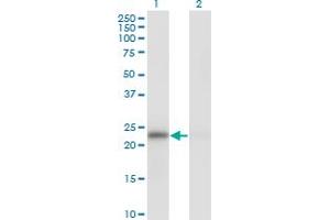Western Blot analysis of MAD2L1 expression in transfected 293T cell line by MAD2L1 monoclonal antibody (M01), clone 2E2-1D6.