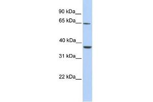 Human Liver; WB Suggested Anti-ZNF677 Antibody Titration: 0. (ZNF677 anticorps  (C-Term))