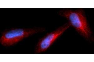 Immunofluorescence (IF) image for anti-Granzyme B (GZMB) (AA 21-247) antibody (PE) (ABIN5564764) (GZMB anticorps  (AA 21-247) (PE))