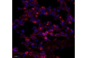 Immunofluorescence of paraffin embedded mouse lung using ARHGAP18 (ABIN7075417) at dilution of 1: 700 (450x lens) (ARHGAP18 anticorps)