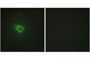 Immunofluorescence analysis of HeLa cells, using JAK1 Antibody. (JAK1 anticorps  (AA 91-140))