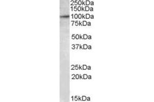 Western Blotting (WB) image for anti-E2F Transcription Factor 7 (E2F7) (AA 53-66) antibody (ABIN490460) (E2F7 anticorps  (AA 53-66))