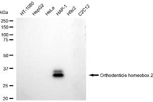 Western blotting analysis using Orthodenticle homeobox 2 antibody (ABIN7799709).