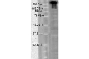 Western Blot analysis of hamster CHO cells showing detection of Nav1. (SCN9A anticorps  (AA 1751-1946) (Atto 390))