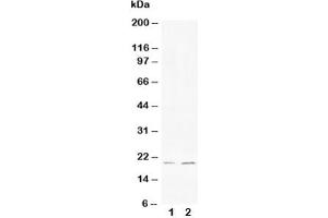 Western blot testing of Bcl-XS antibody and Lane 1:  HeLa (Bcl-X/s (AA 120-130) anticorps)