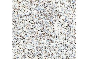 IHC analysis of PCNA using anti-PCNA antibody (ABIN7599179).