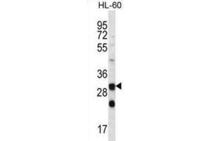 Western Blotting (WB) image for anti-Carbonic Anhydrase VI (CA6) antibody (ABIN2996883)