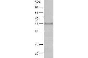 Western Blotting (WB) image for Receptor Tyrosine Kinase-Like Orphan Receptor 1 (ROR1) (AA 30-406) protein (His-IF2DI Tag) (ABIN7124800)