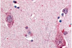 Anti-NTRK2 / TRKB antibody  ABIN1049153 IHC staining of human brain, neurons.