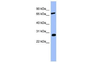 COMT antibody used at 1 ug/ml to detect target protein. (COMT anticorps  (Middle Region))