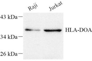 Western blot analysis of HLADOA (ABIN7074244) at dilution of 1: 1500