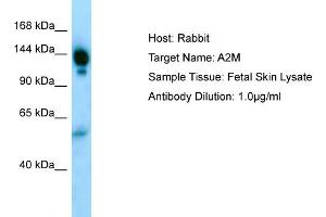 Host: RabbitTarget Name: A2MAntibody Dilution: 1. (alpha 2 Macroglobulin anticorps  (N-Term))