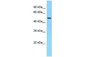 WB Suggested Anti-Eif5 Antibody Titration: 1. (EIF5 anticorps  (C-Term))