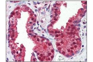 Immunohistochemistry (IHC) image for anti-Folate Hydrolase (Prostate-Specific Membrane Antigen) 1 (FOLH1) (AA 117-351) antibody (ABIN317554) (PSMA anticorps  (AA 117-351))