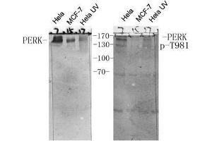 Western Blot (WB) analysis of specific cells using antibody diluted at 1:1000. (PERK anticorps  (pThr981))
