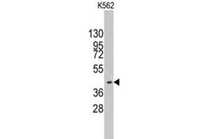 Western Blotting (WB) image for anti-K(lysine) Acetyltransferase 8 (KAT8) antibody (ABIN2996053) (MYST1 anticorps)