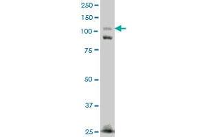 FNDC3A monoclonal antibody (M01), clone 2H4 Western Blot analysis of FNDC3A expression in A-431 . (FNDC3A anticorps  (AA 1012-1110))