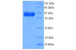 SDS-PAGE (SDS) image for 5-Methyltetrahydrofolate-Homocysteine Methyltransferase (MTR) (AA 923-1265) protein (His tag) (ABIN5714456) (MTR Protein (AA 923-1265) (His tag))