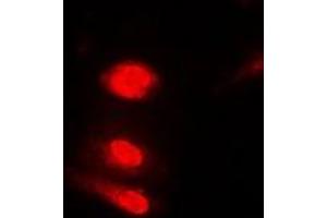Immunofluorescent analysis of Annexin A11 staining in Jurkat cells.