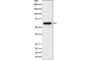 Western blot analysis of HRPT2/CDC73 expression in 293T cell lysate.