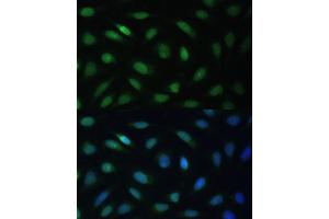 Immunofluorescence analysis of U-2 OS cells using LBR Polyclonal Antibody (ABIN6128194, ABIN6143105, ABIN6143106 and ABIN6221130) at dilution of 1:100 (40x lens).