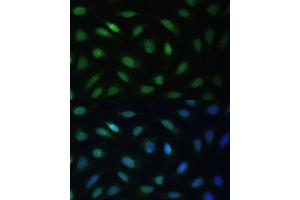 Immunofluorescence analysis of U-2 OS cells using LBR Polyclonal Antibody (ABIN6128194, ABIN6143105, ABIN6143106 and ABIN6221130) at dilution of 1:100 (40x lens). (Lamin B Receptor anticorps  (AA 1-211))