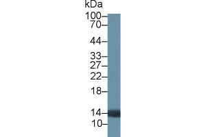 Detection of PTK6 in Rat Prostate lysate using Polyclonal Antibody to Protein Tyrosine Kinase 6 (PTK6) (PTK6 anticorps  (AA 191-445))