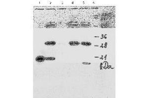 Western Blotting (WB) image for anti-Human Papilloma Virus 18 E7 (HPV-18 E7) (AA 1-35), (N-Term) antibody (ABIN781779) (HPV18 E7 anticorps  (N-Term))
