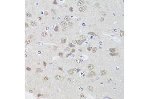 Immunohistochemistry of paraffin-embedded rat brain using PPP1CC antibody (ABIN5972199) at dilution of 1/100 (40x lens). (PPP1CC anticorps)