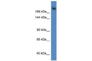 WB Suggested Anti-WDR87 Antibody Titration: 1. (WDR87 anticorps  (C-Term))