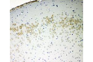 Anti-VE Cadherin antibody, IHC(P) IHC(P): Rat Brain Tissue (Cadherin 5 anticorps  (C-Term))