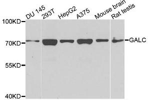Western blot analysis of extracts of various cells, using GALC antibody. (GALC anticorps)