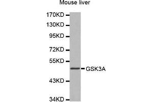 Western Blotting (WB) image for anti-Glycogen Synthase Kinase 3 alpha (GSK3a) (AA 409-483) antibody (ABIN1680131)