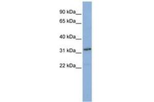 Image no. 1 for anti-Small Nuclear RNA Activating Complex, Polypeptide 2, 45kDa (SNAPC2) (AA 36-85) antibody (ABIN6740258) (SNAPC2 anticorps  (AA 36-85))