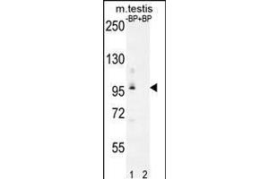 Western blot analysis of PDPR Antibody Pab pre-incubated without(lane 1) and with(lane 2) blocking peptide in mouse testis tissue lysate (PDP anticorps  (C-Term))