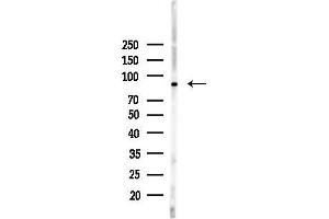 Western blot analysis of lysates from Hela cells(heat-shock,45 min treatment), using Phospho-Calnexin (Ser564) Antibody at 1/1000 dilution.