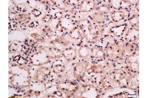 Formalin-fixed and paraffin embedded human kidney labeled with Anti-GRB10/14 Polyclonal Antibody, Unconjugated  at 1:300 followed by conjugation to the secondary antibody and DAB staining. (GRB10/14 (AA 501-594) anticorps)